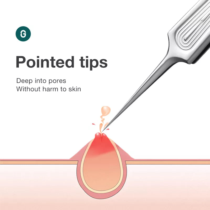 Ingrown Hair Tweezers Needle Nose Pointed