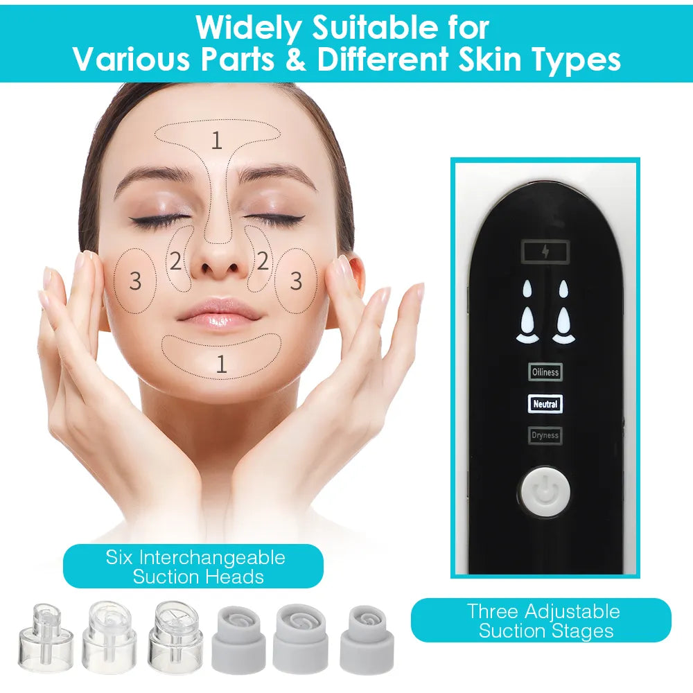 Blackhead Remover Pore Cleaner Vacuum