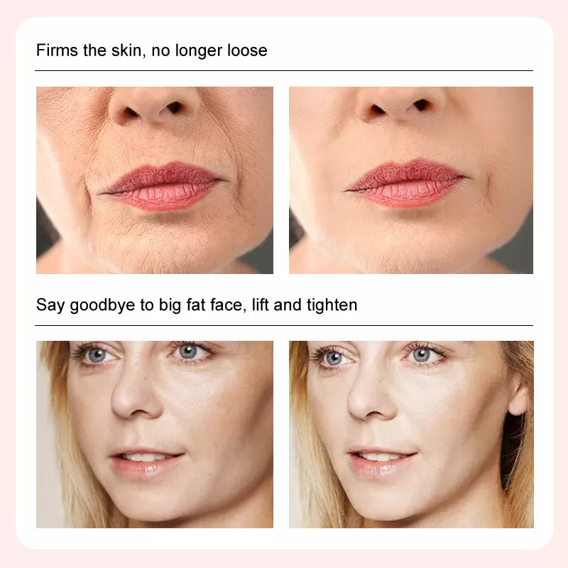 Face-lift Cream